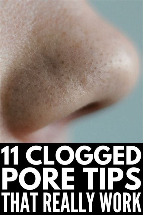 Clogged Pores Remedies Clogged Pores On Nose Clean Nose Pores