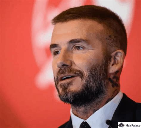 David Beckham Hair Transplant Story The Truth Behind It