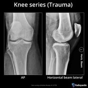 Knee Series Radiology Reference Article Radiopaedia Org