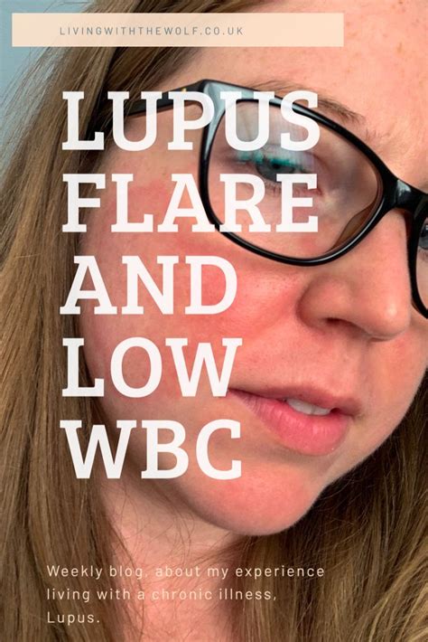 Lupus Flare And A Low Wbc Lupus Flare Lupus Flare Up Lupus
