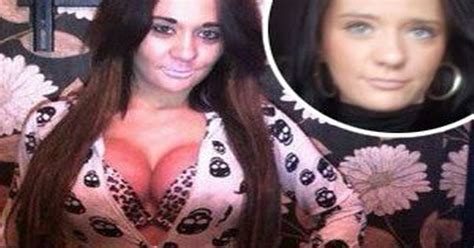 Josie Cunningham Before And After Surgery Rep Reveals Throwback Snap Of Her Wearing No Make Up