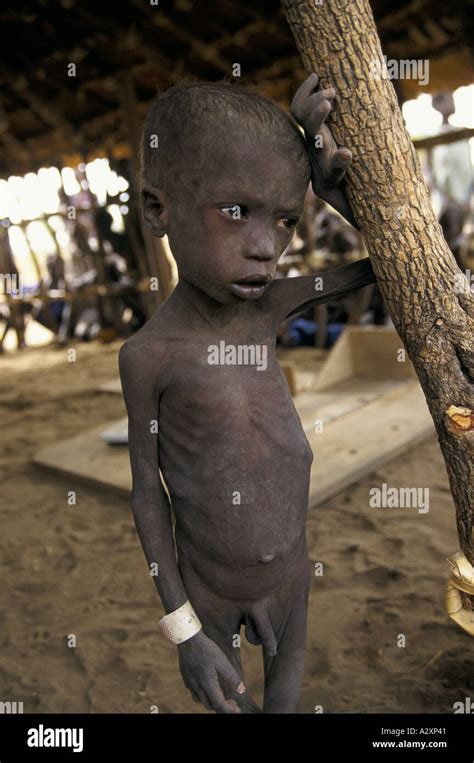 Impending Famine Sudan Malnourished Child 1998 Stock Photo Alamy