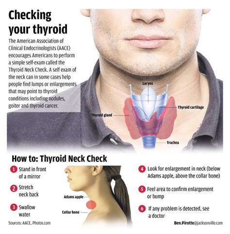 See This Diagram To Learn How To Check Yourself For Thyroid