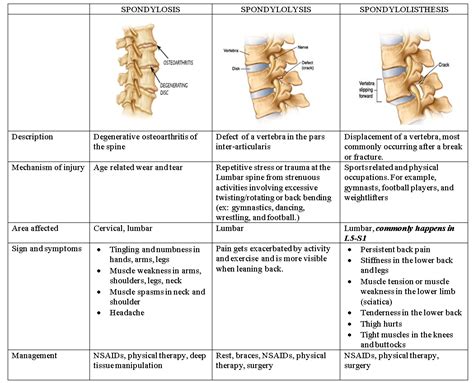 Introduction Of Back Pain Types And Management