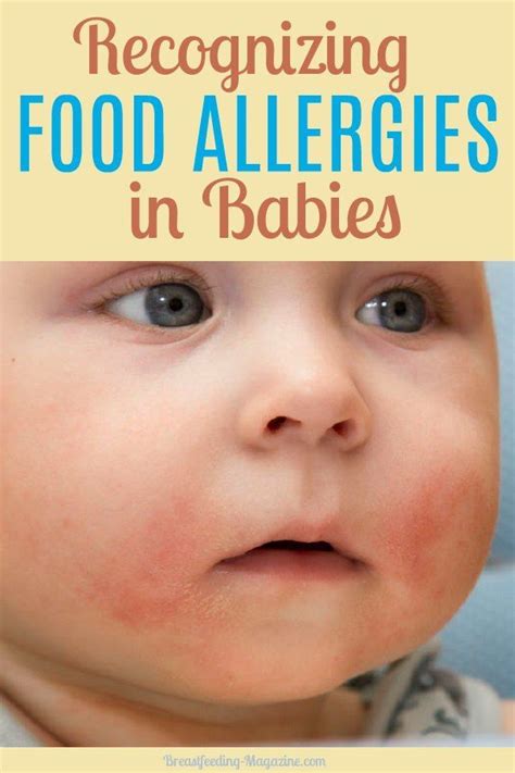 Signs Of Food Intolerance In Babies Babbies Cip