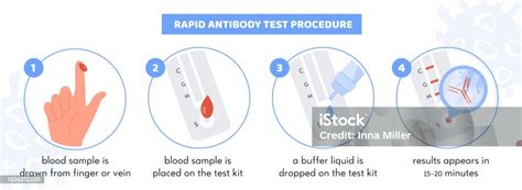 Covid19 Rapid Antibody Test Procedure Infographic Test Kit With Patient