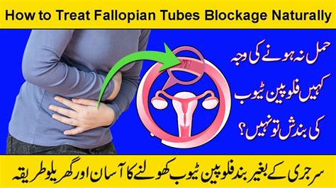 How To Treat Fallopian Tubes Blockage Naturally Can You Get Pregnant With Blocked Tubes Youtube