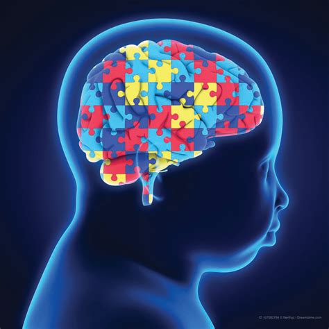Imaging Advances Toward Autism Diagnosis