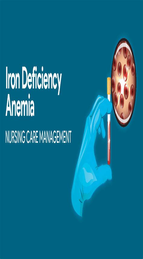10 Signs And Symptoms Of Iron Deficiency In 2020