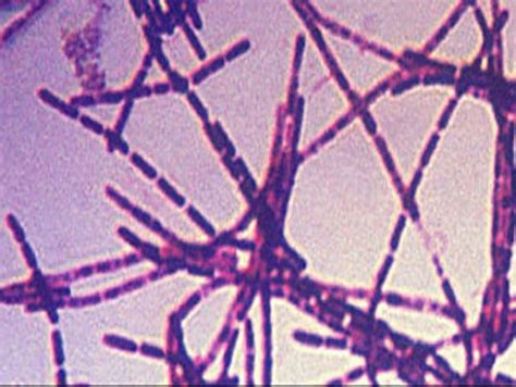 Anthrax Scare Is Latest Safety Lapse At Cdc Labs