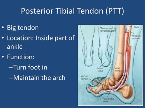 Ppt My Ankleposterior Tibial Tendon Insufficiency Powerpoint
