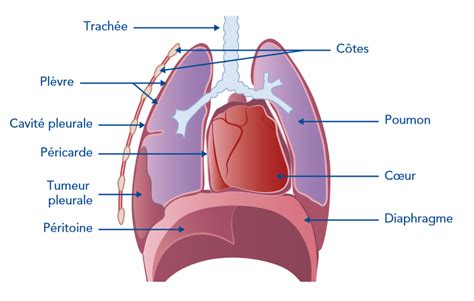 Learn vocabulary, terms and more with flashcards, games and other only rub 220.84/month. Le mésothéliome pleural malin