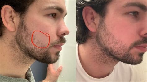 Beard Growth Update Month Youtube
