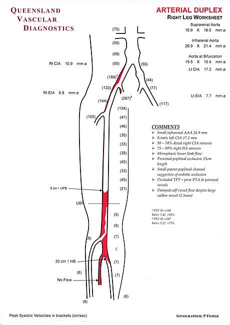 Lower Extremity Arteries Queensland Vascular Diognostics