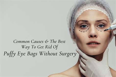Common Causes And The Best Way To Get Rid Of Puffy Eye Bags Without