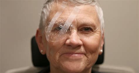 How To Take Care Of Eye After Cataract Surgery Ariamedtour