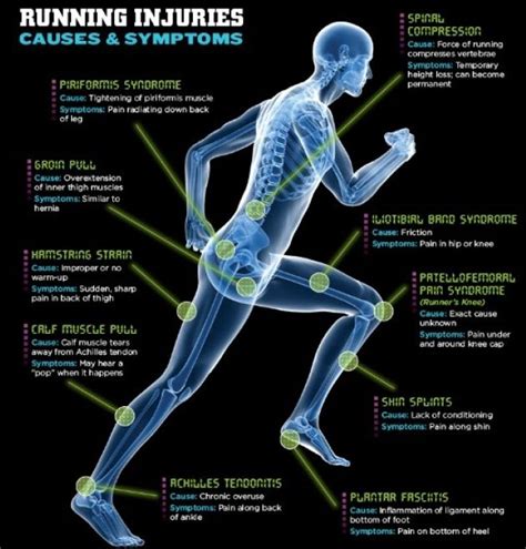 Programme De Musculation Pour Progresser Au Sprint Running Injury