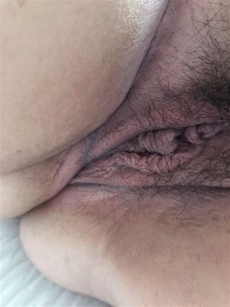 Bbw Meaty Hairy Pussy Lips Swollen Clit Huge Labia 5 Pics Xhamster
