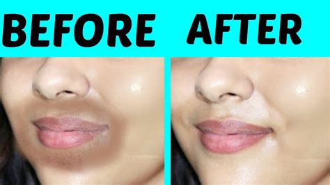 How To Remove Dark Spots Below Lips