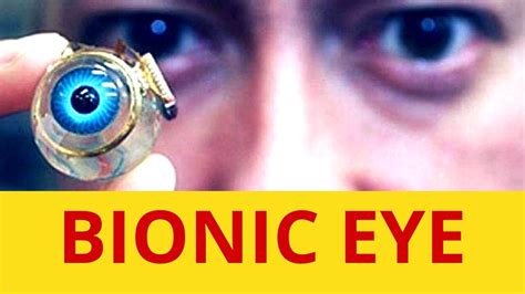 The Worlds First Bionic Eye Transplant Youtube