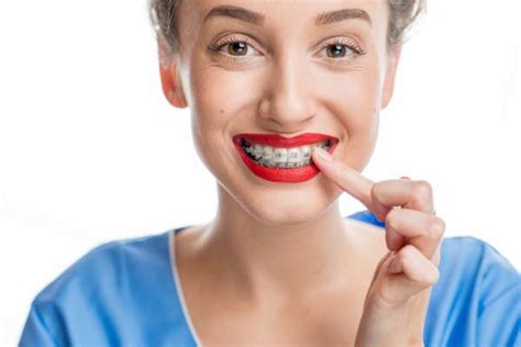 Adult Orthodontic Treatments For Tooth Crowding Visalia Care Dental