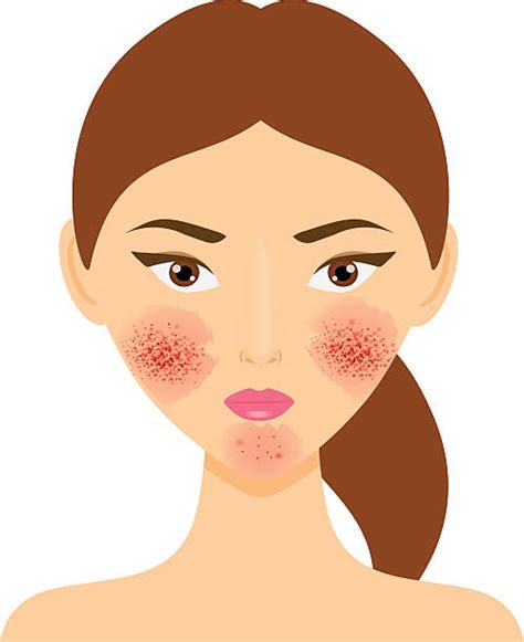 Skin Condition Clip Art Vector Images And Illustrations Istock