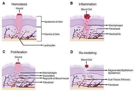 Wound Healing Stages Demonstrated On The Three Layers Of Human Skin