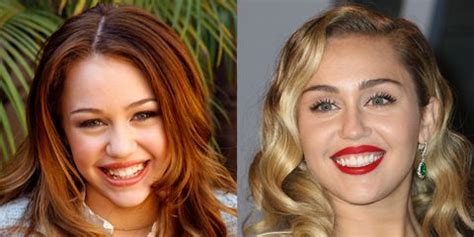 Hilary duff's teeth before the surgery. 10 Celebrities with Veneers - Celebrities Who Had Major Teeth Transformations