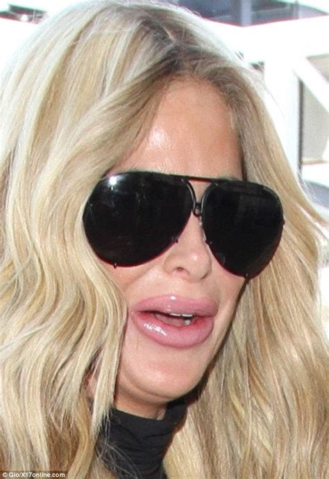 Kim Zolciak Emerges With Very Plump Lips After Trip To La Daily Mail