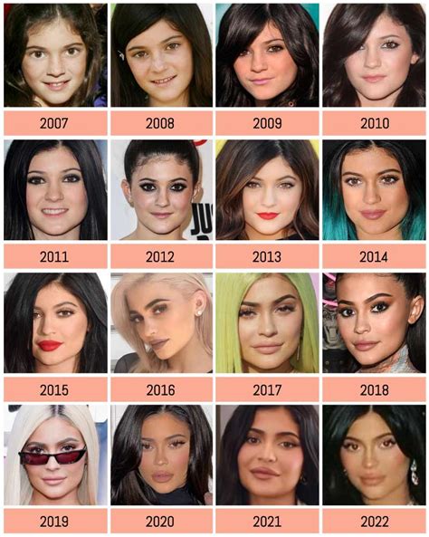 Arhitect Distruge Observație Kylie Jenner Before Cosmetic Surgery A
