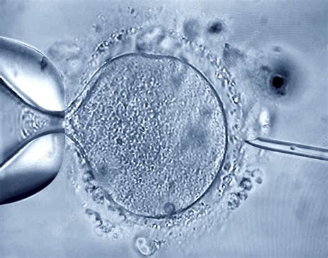 In Vitro Fertilisation Light Micrograph Stock Image C0403058