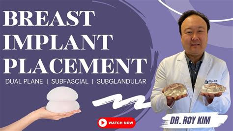 Best Placement For Breast Implants Exploring Dual Plane Subfascial And Subglandular Youtube