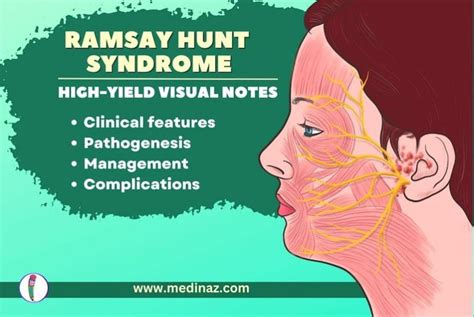 Ramsay Hunt Syndrome Hy Medicine Notes