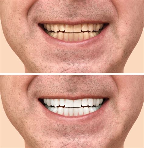 Cosmetic Dentistry Southern Dental