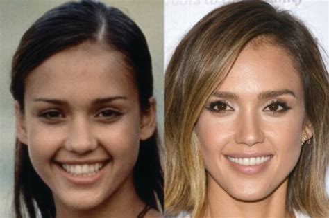 Has Jessica Alba Had Cosmetic Surgery Mya Cosmetic Surgery