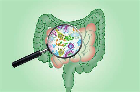 Supercrescimento bacteriano (SIBO): tratamento e diagnóstico - Clínica Картинка - Supercrescimento bacteriano (SIBO): tratamento e diagnóstico - Clínica