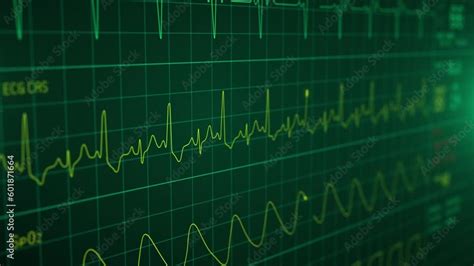 Patient Monitor Displays Vital Signs Ecg Electrocardiogram Ekg Oxygen