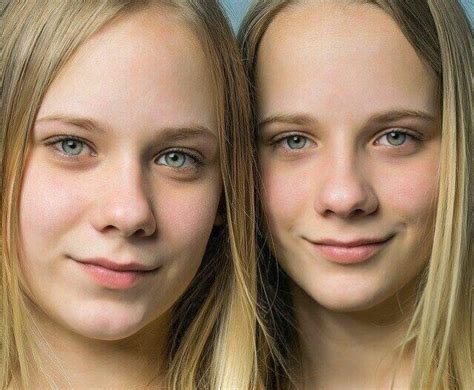 4 difference between monozygotic and dizygotic twins 2023