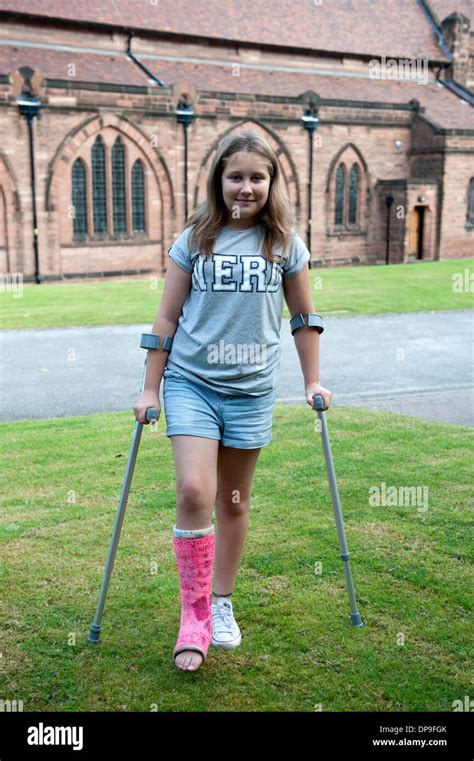 Teenage Girl On Crutches Broken Leg Plaster Pink Fully Model Released