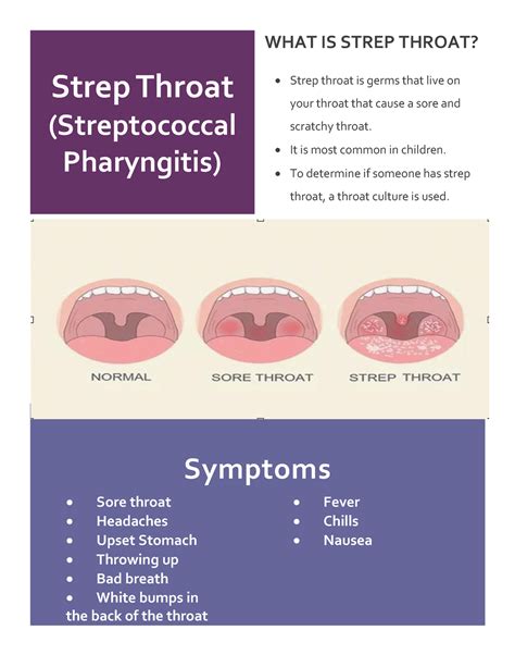 Strep Throat Booklet Strep Throat Streptococcal Pharyngitis What Is Strep Throat • Strep