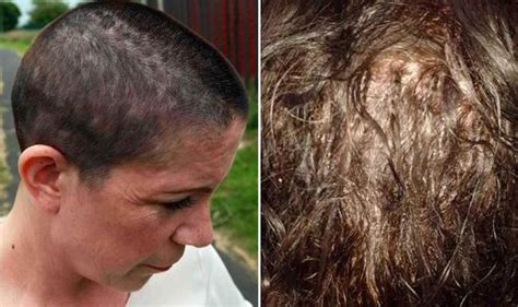 Leave it on for two hours. Mum left with bleeding scalp after hair extensions applied ...