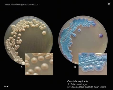 Candida Tropicalis An Overview