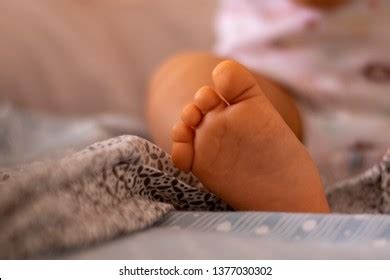 Close Baby Legs Feet Syndactyly Condition Stock Photo Shutterstock