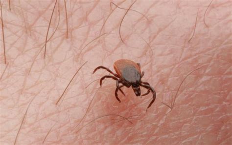Tick Bites Symptoms Treatments Pictures And Prevention General