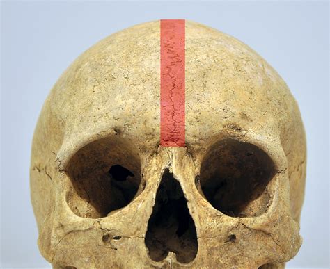 Bones Of The Skull Skull Osteology Anatomy Geeky Medics