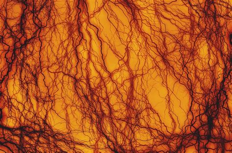 Amazing Scientists Grow Human Blood Vessels In A Petri Dish And Its
