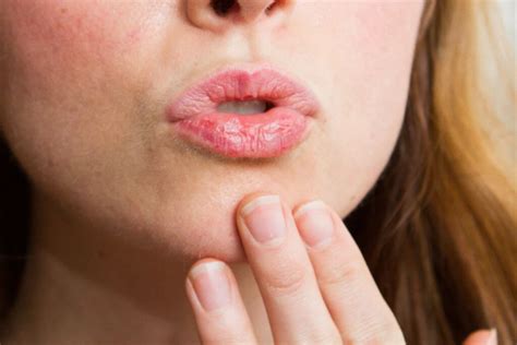 Почему жжение во рту причины Синдром жжения полости рта Oralhealthfoundationrussian