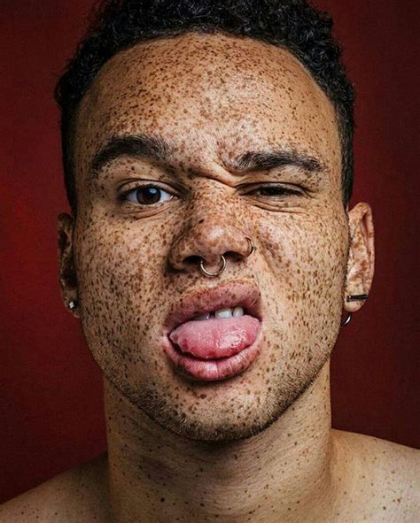 These Portraits Celebrate The Joy Of Having Freckles In 2021 Face