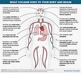 What Can Marijuana Do To Your Brain Pictures