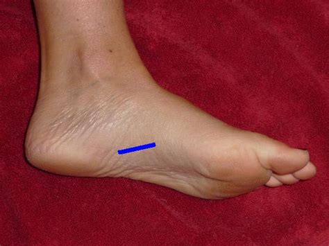 The foot is a complex system of bones, muscles. foot pathology ultrasound